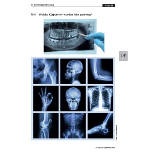 Die Röntgenstrahlung - Voller Durchblick